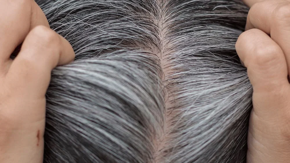 Are you suffering from White hair?