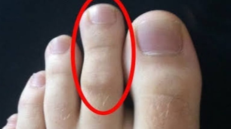 Toes