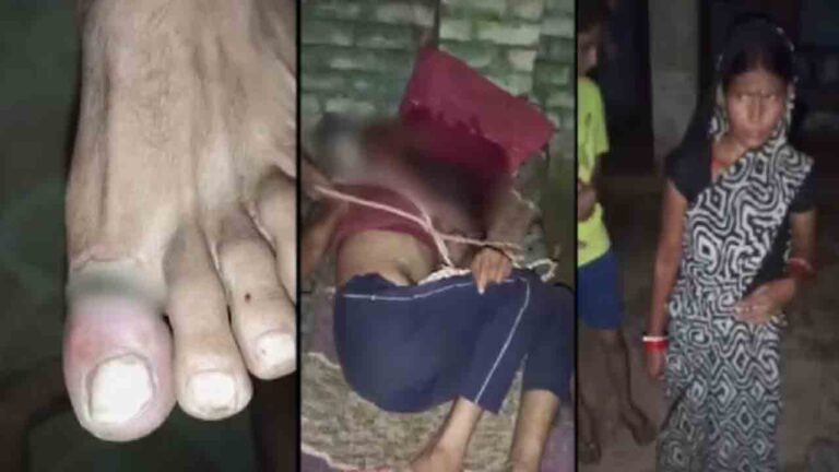 woman ties husband to cot, beats