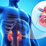 homeopathy cure kidney disease